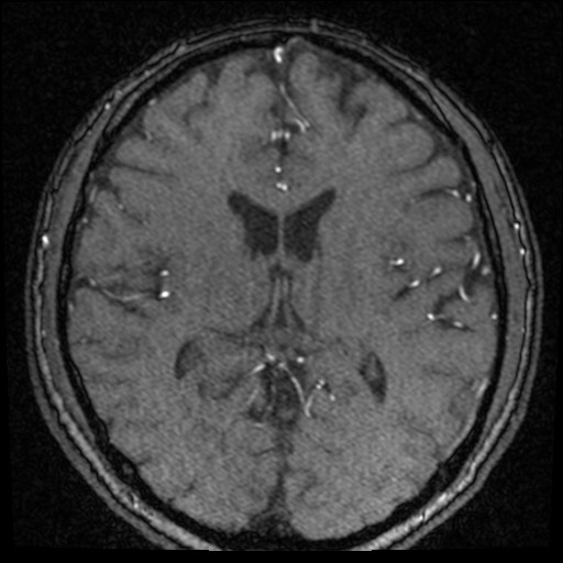 Click on the Serie image to view the images of VILLANUEVA, WILLIAM A.